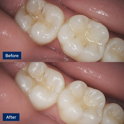 DentMD™ Tooth Renewal Serum